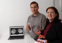 Medica 2018: Diagnose-Software spürt Arterienverkalkung früh auf