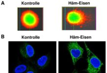 Der Entstehung von Darmkrebs auf der Spur: Wie Häm-Eisen aus rotem Fleisch gesunde Darmzellen schädigt