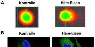 Der Entstehung von Darmkrebs auf der Spur: Wie Häm-Eisen aus rotem Fleisch gesunde Darmzellen schädigt