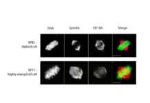 Krebserkrankungen haben eine gemeinsame „Schwachstelle“